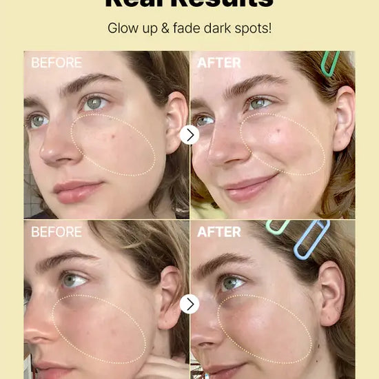 The Vitamin C 23 Serum Results