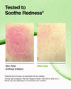 Azelaic Acid 10 Hyaluron Redness Soothing Serum
