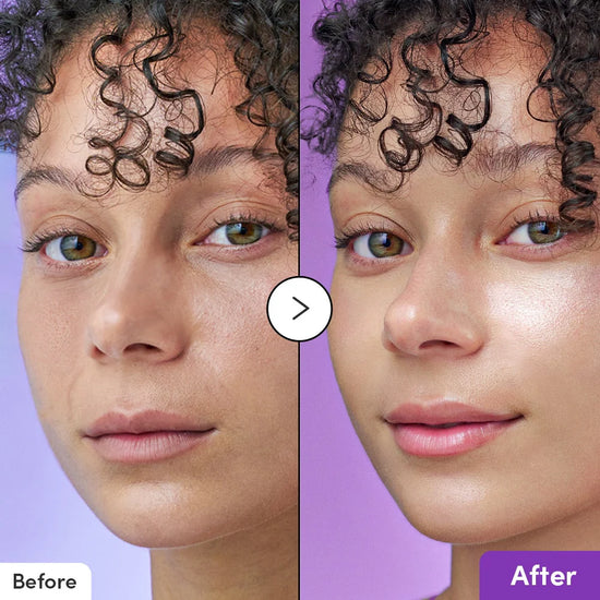Before and after comparison of a woman's face with a purple background