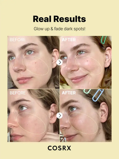 The Vitamin C 23 Serum Results