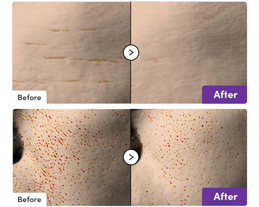 Before and after comparison of skin treatment on a person's face.