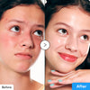 EQQUAL BERRY Blue Blow Hyaltoin Flooding Serum - 30ml